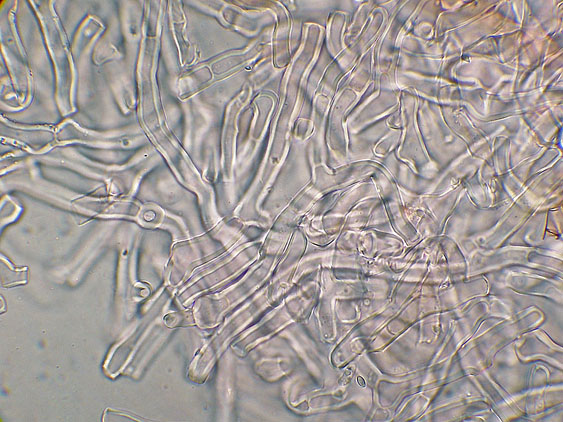 Quiz N.9 (Phanerochaete sordida )