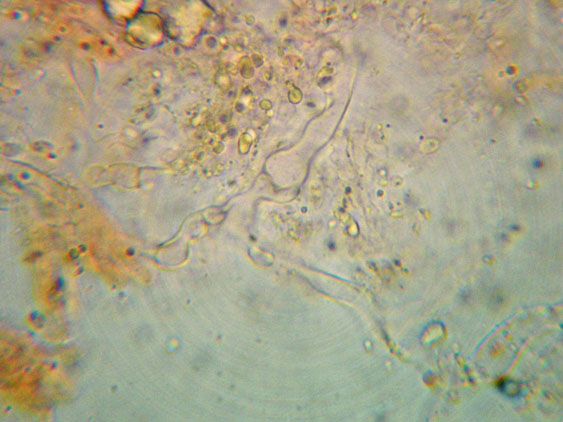 Da determinare (Ceraceomyces serpens)