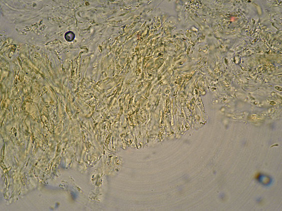 Curiosità più che determinaz.-foto6074(Postia leucomallella)