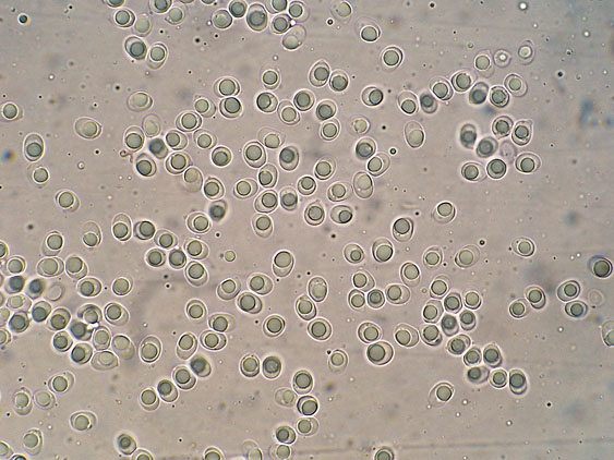 Quiz N.8 (Hyphoderma sambuci)