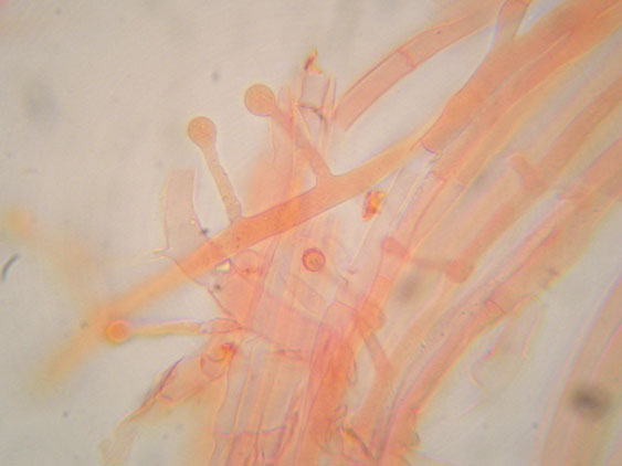 Raccolte del 9 Novembre