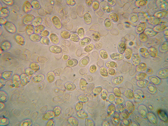 Mycena da determinare (cfr. Mycena galericulata)