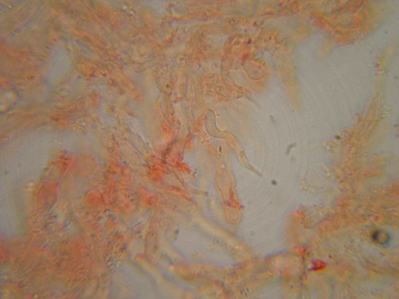 Piccola crosta su Ginestra (Hyphodontia juniper)