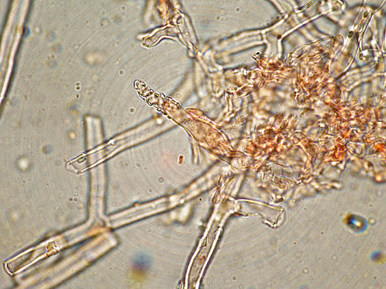 Phanerochaete con Gaf?