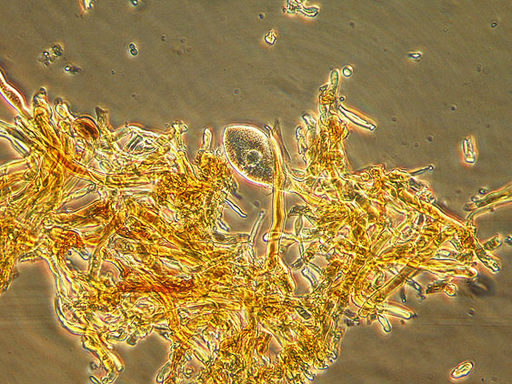 Quiz N.4 (Phaeolus schweinitzii)