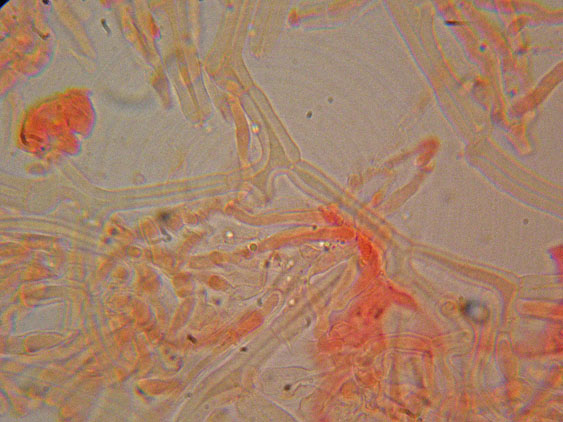 Phanerochaete da determinare (Phanerochaete sordida)