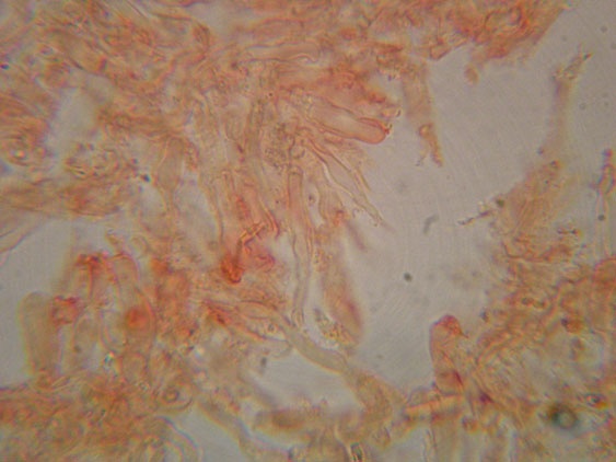 Piccola crosta su Ginestra (Hyphodontia juniper)