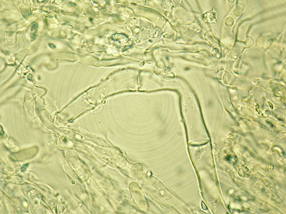 Due croste forse una su abete-foto0555(Hyphoderma setigerum)