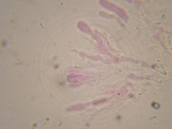 Hyphoderma roseocremeum? (Hyphoderma roseocremeum)