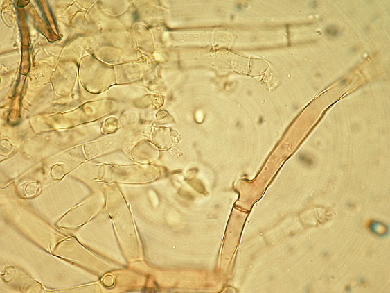 Botryobasidium da determinare