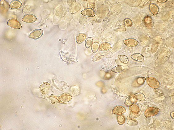 Inocybe da determinare