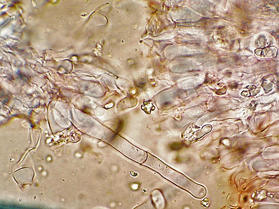 Peniophorella praetermissa (P. Karst.) K.H. Larss.