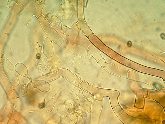 Botryobasidium da determinare