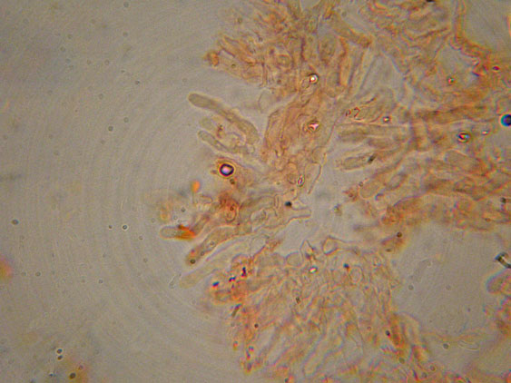 Crosticina senza rizomorfe (Trechispora confinis)