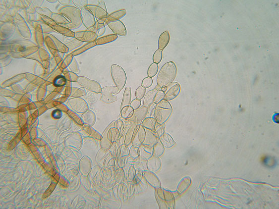 Raccolte del 2 Maggio