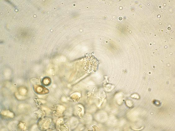 Inocybe da determinare