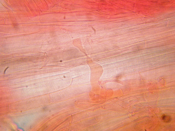 Raccolte del 9 Novembre