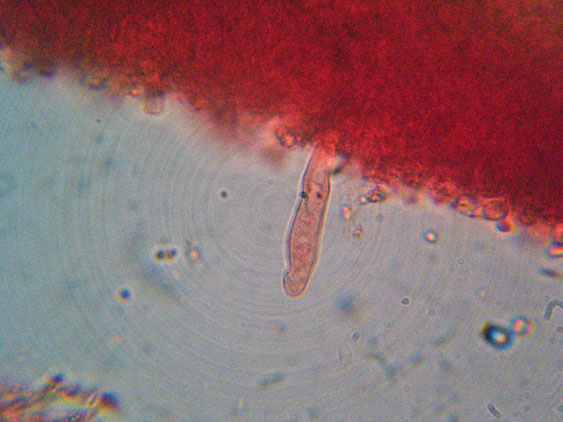 Phanerochaete raduloides? (Phanerochaete aculeata)