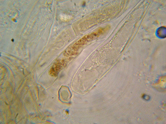 Raccolte del 30 e  31 Maggio