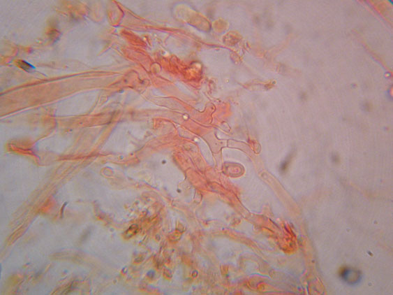 Gloiothele lactescens? (Gloiothele lactescens)