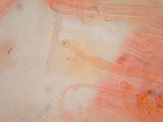 Raccolte del 9 Novembre