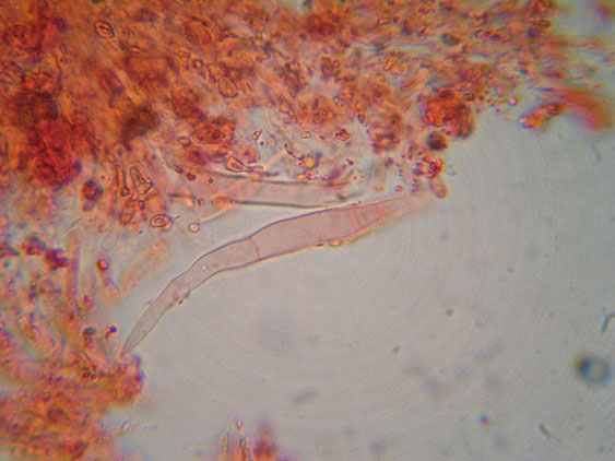 Phanerochaete raduloides? (Phanerochaete aculeata)