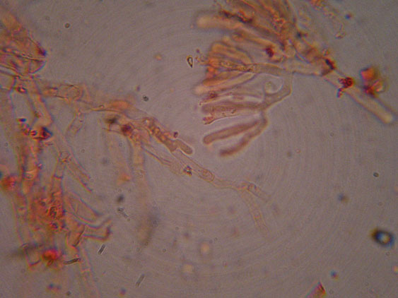 Phanerochaete raduloides? (Phanerochaete aculeata)