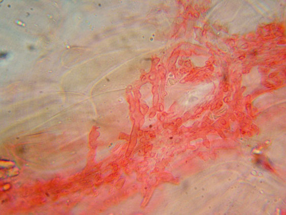 Mycena da determinare (cfr. Mycena galericulata)