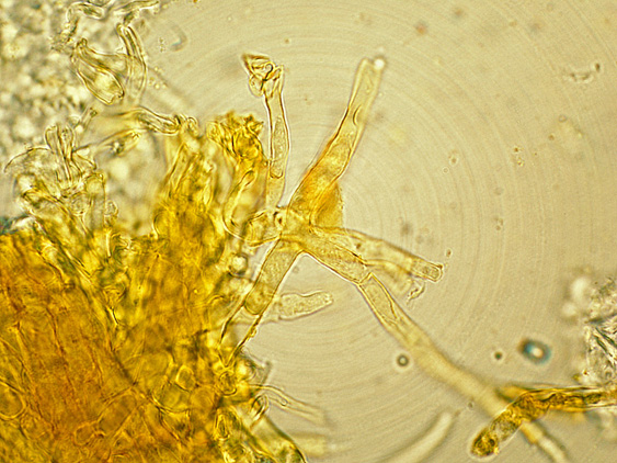 Quiz N.4 (Phaeolus schweinitzii)