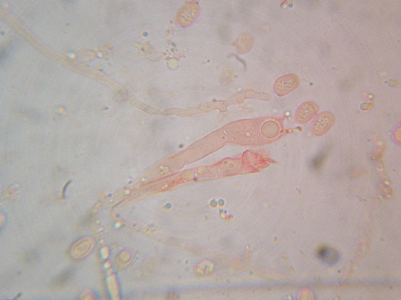 Gloiothele lactescens? (Gloiothele lactescens)