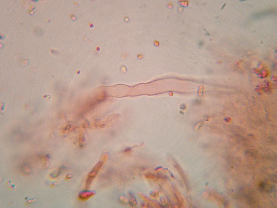Phanerochaete raduloides? (Phanerochaete aculeata)