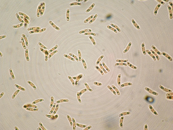 Tubulicrinis subulatus
