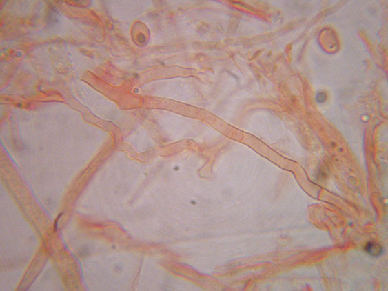 Gloiothele lactescens? (Gloiothele lactescens)