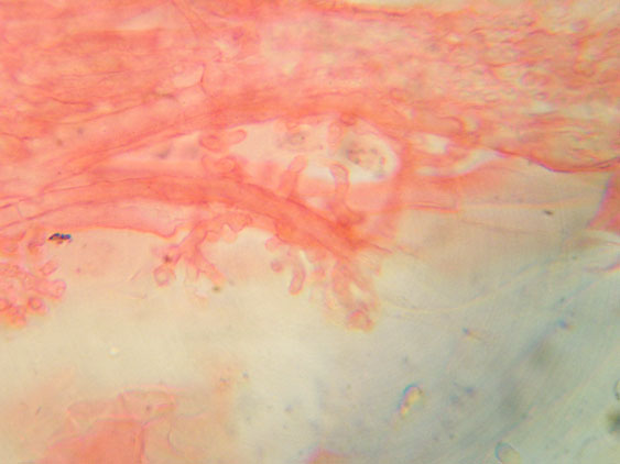 Mycena da determinare (cfr. Mycena galericulata)