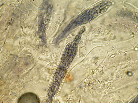 Peniophora lilacea Bourdot & Galzin