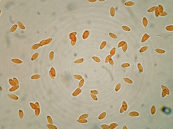 Botryobasidium subcoronatum (Höhn. & Litsch.)