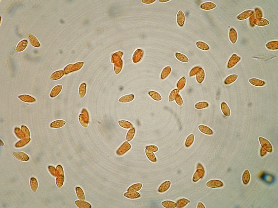 Botryobasidium subcoronatum (Hhn. & Litsch.)