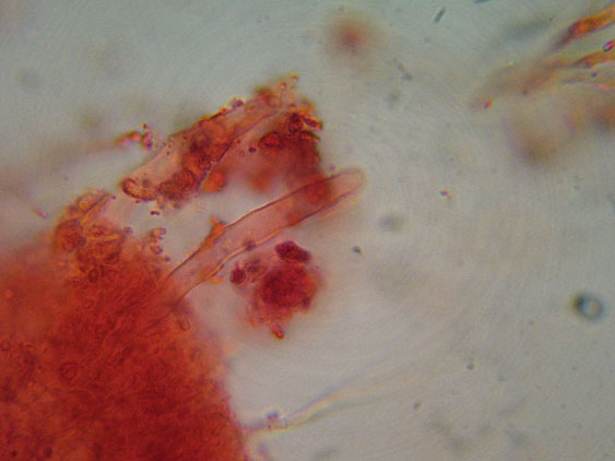Phanerochaete raduloides? (Phanerochaete aculeata)