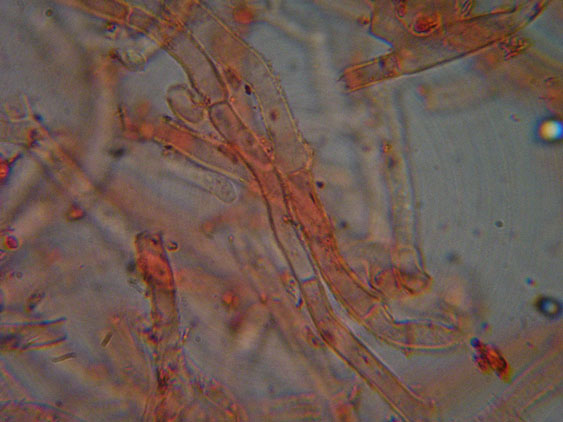 Phanerochaete raduloides? (Phanerochaete aculeata)