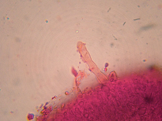 Phanerochaete raduloides? (Phanerochaete aculeata)