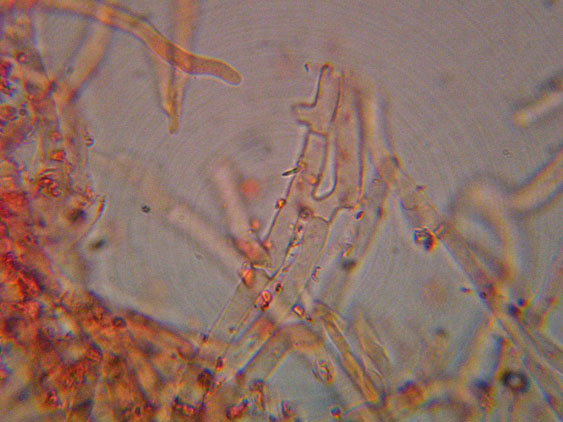 Phanerochaete raduloides? (Phanerochaete aculeata)