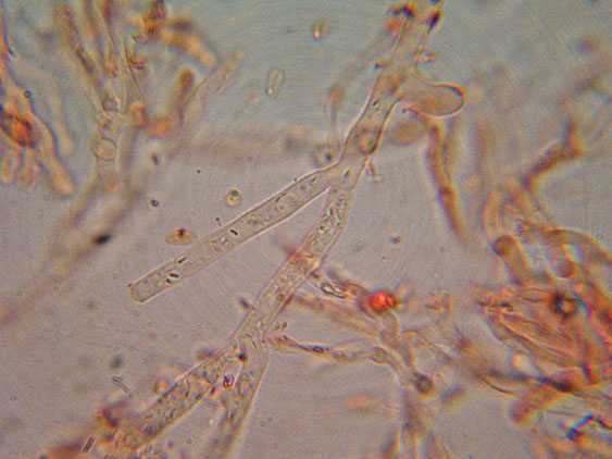 Phanerochaete raduloides? (Phanerochaete aculeata)