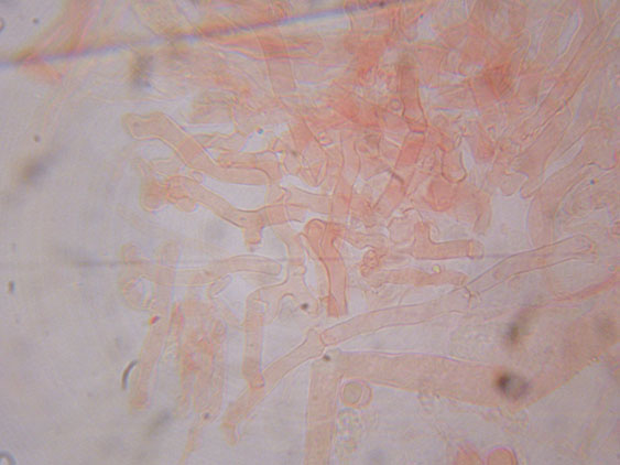 Gloiothele lactescens? (Gloiothele lactescens)