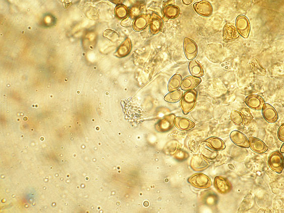 Inocybe da determinare