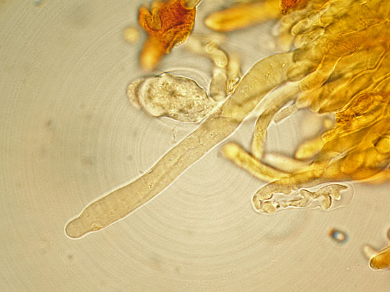 Quiz N.4 (Phaeolus schweinitzii)