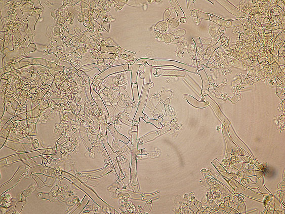 Botryobasidium subcoronatum (Höhn. & Litsch.)