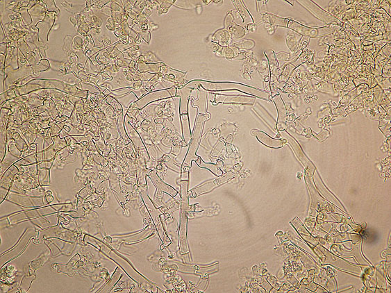 Botryobasidium subcoronatum (Hhn. & Litsch.)