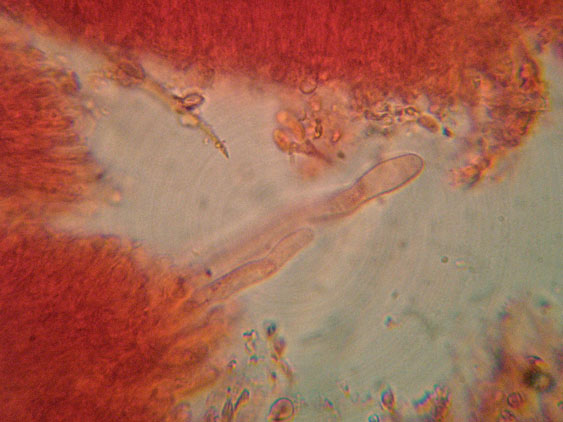 Phanerochaete raduloides? (Phanerochaete aculeata)