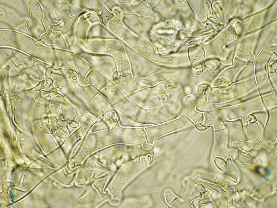 Botryobasidium subcoronatum (Höhn. & Litsch.)