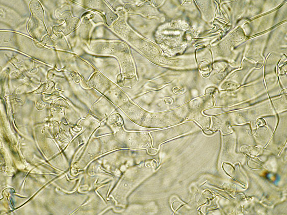 Botryobasidium subcoronatum (Hhn. & Litsch.)